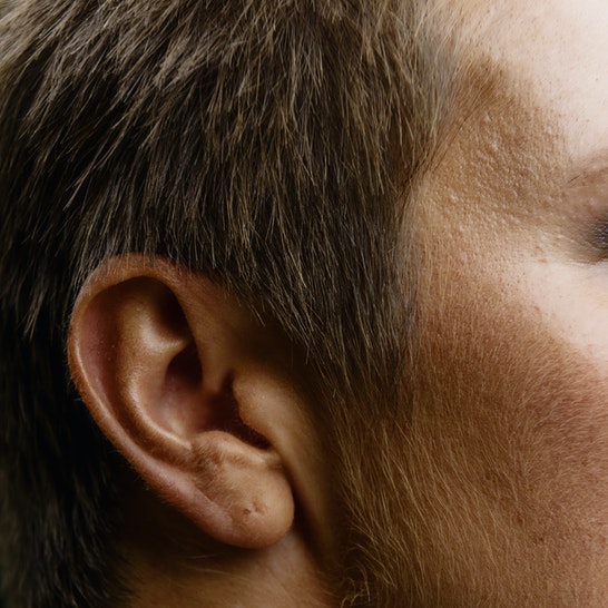 Affections of the Ears